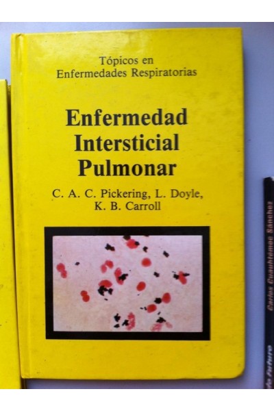TOPICOS EN ENFERMEDADES RESPIRATORIAS. Enfermedad Intersticial Pulmonar